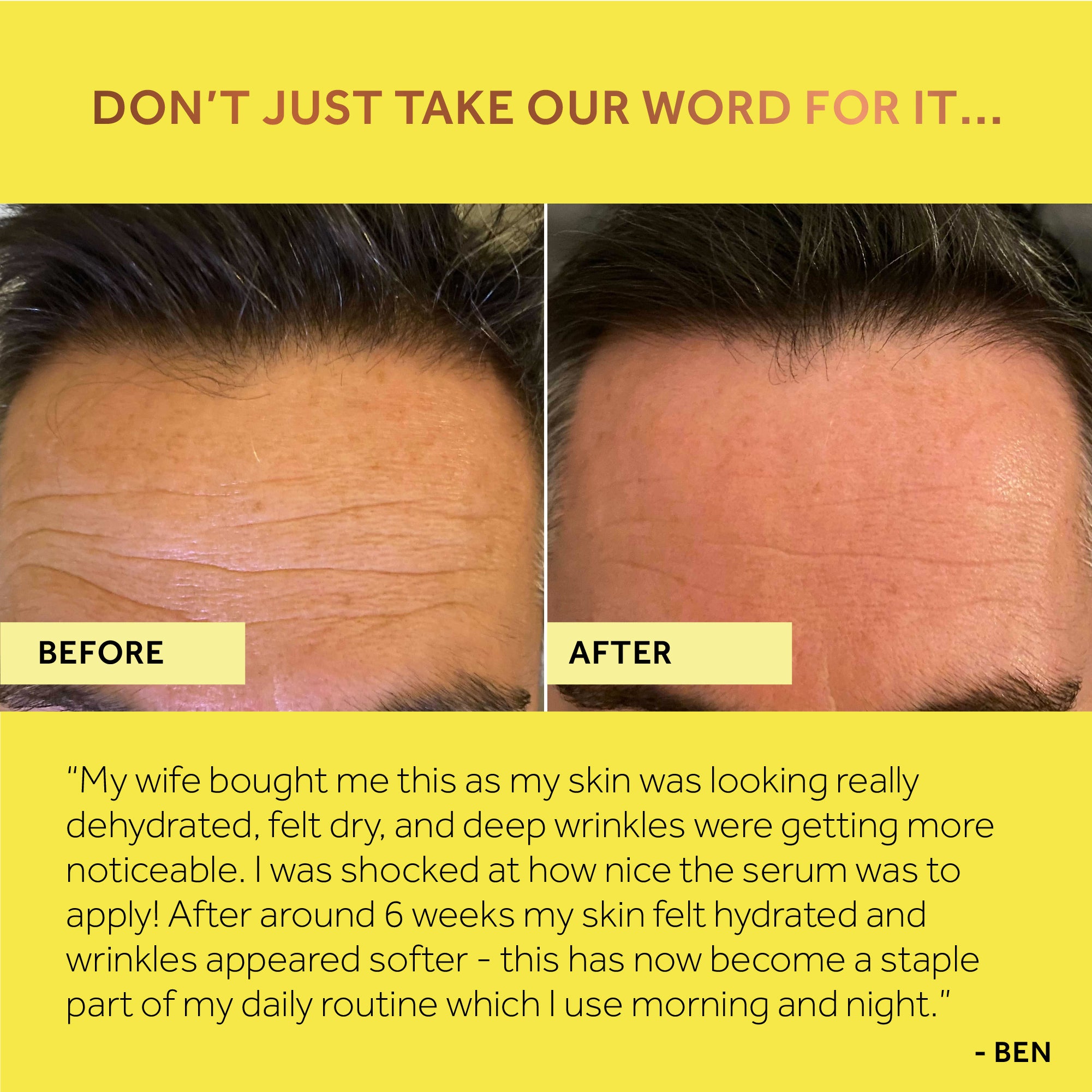 #Absoluter Price - Collagen Booster Serum With Hyaluronic Acid